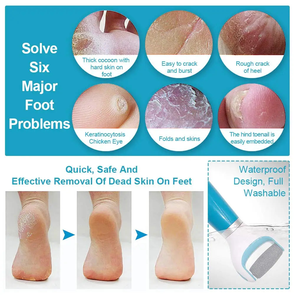 Electric Foot File Vacuum Callus Remover Pedicure Tools Dead Skin Callus Remover Foot Files USB Rechargeable Foot Skin Care Tool